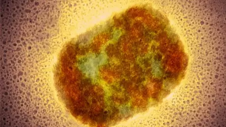 Vírus da varíola dos macacos, identificado pela primeira vez em duas décadas nos EUA