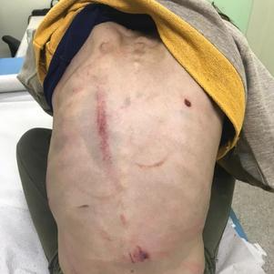 Criança estava magra e com diversos hematomas pelo corpo