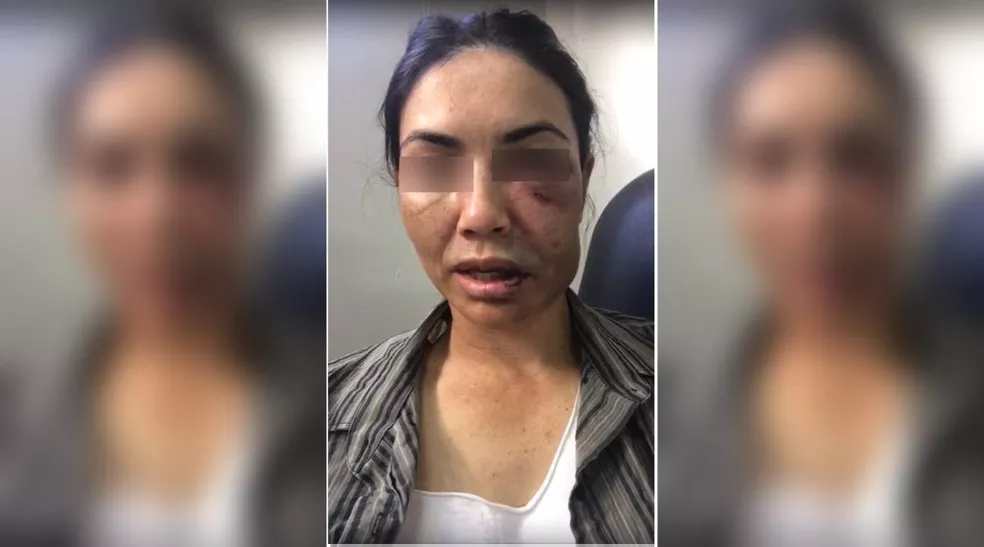 Motorista de transporte por aplicativo foi espancada por assaltantes durante uma corrida na madrugada deste sábado (24) em Tangará da Serra — Foto: Divulgação