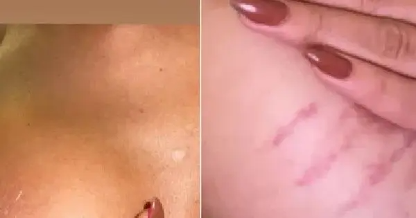 Atriz de nova novela da Globo mostra hematomas e denuncia transfobia: 'Sem  forças' - iBahia