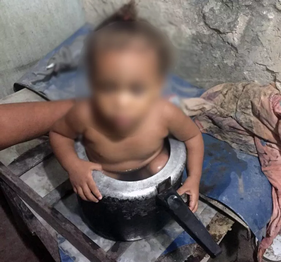 Criança entrou em panela de pressão e ficou presa em Goiana — Foto: Reprodução/WhatsApp Criança entrou em panela de pressão e ficou presa em Goiana — Foto: Reprodução/WhatsApp