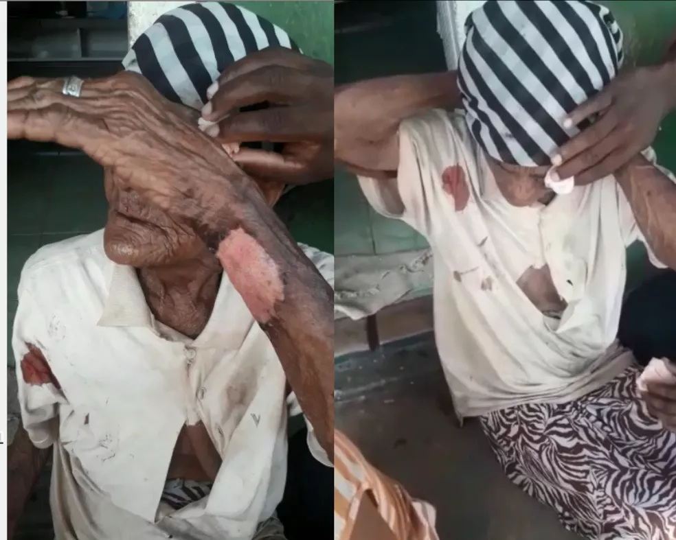 Idosa de 103 anos é agredida durante assalto — Foto: Redes Sociais